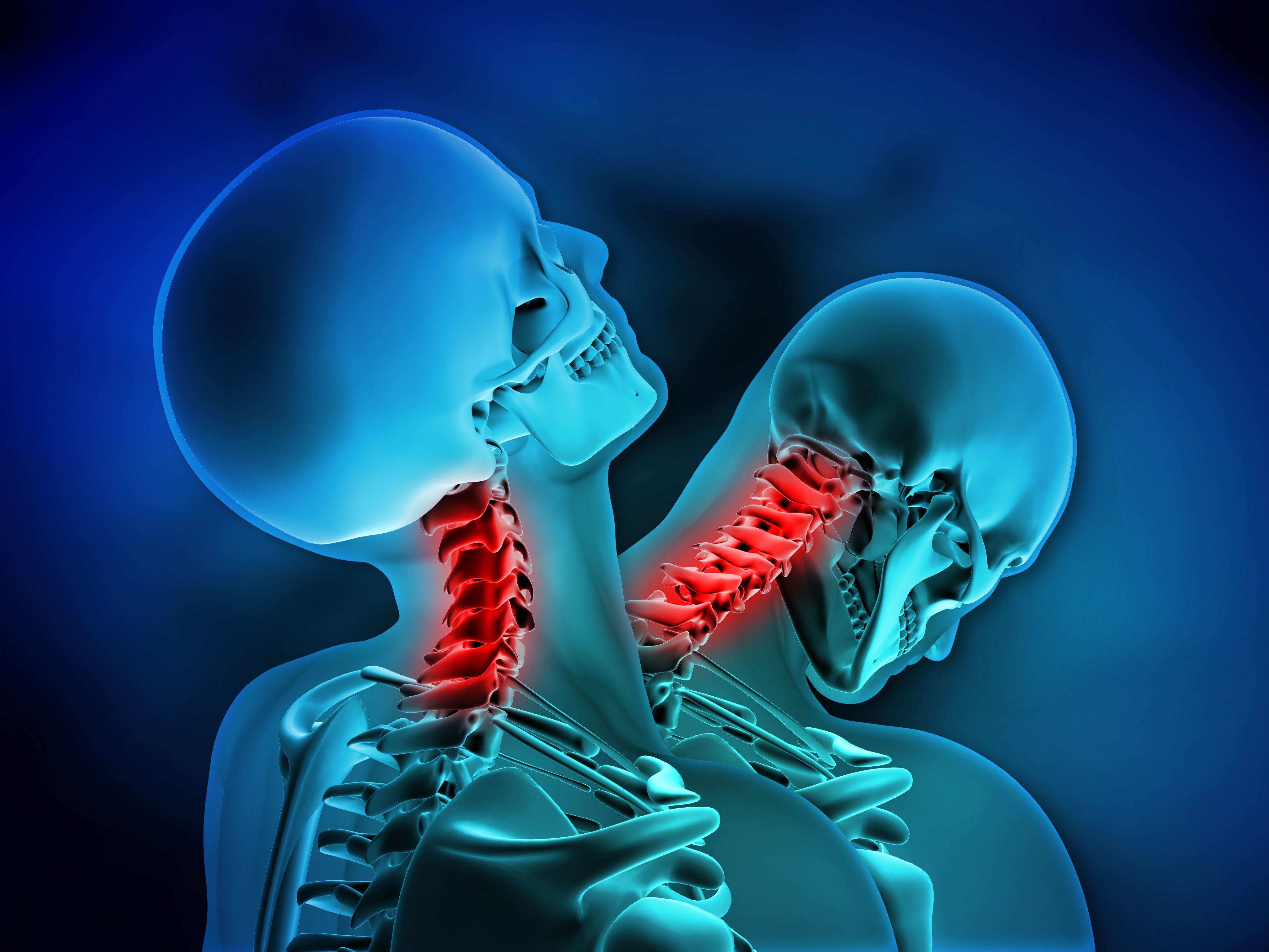 What is whiplash injury worth?